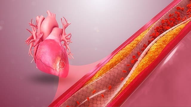 Factores-de-riesgo-de-enfermedades-cardiovasculares