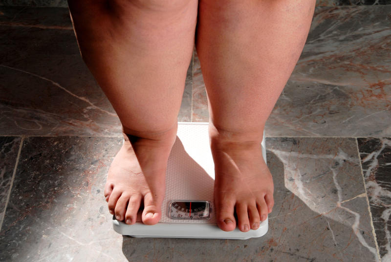 En la obesidad ginoide, el exceso de grasa se deposita en caderas, glúteos, caderas, piernas y muslos - Retos